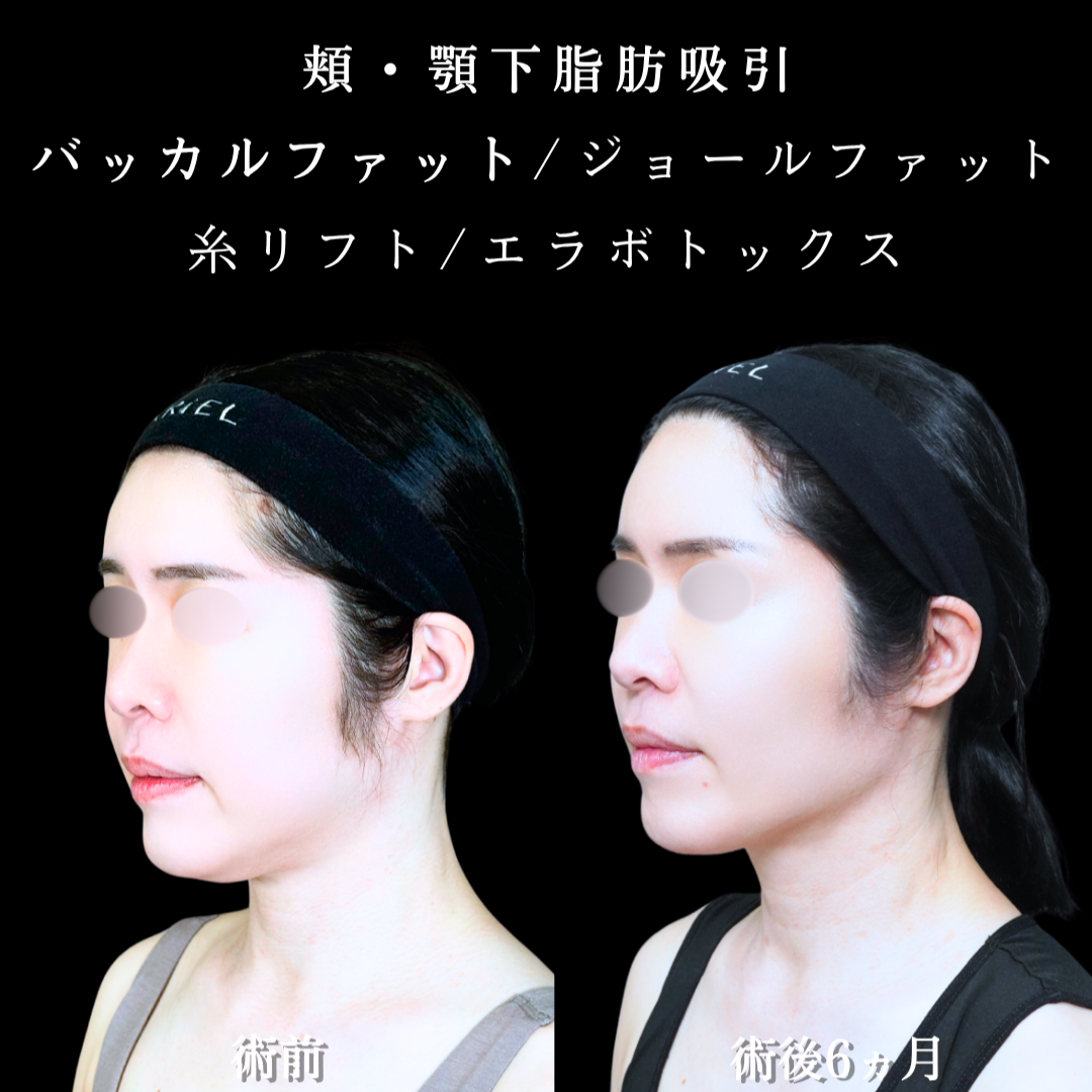 No.21253の症例写真2
