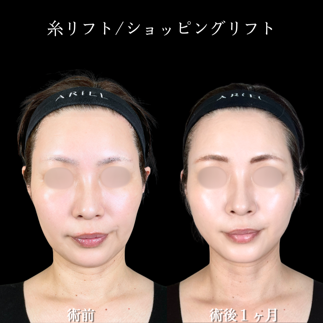 No.21260の症例写真2