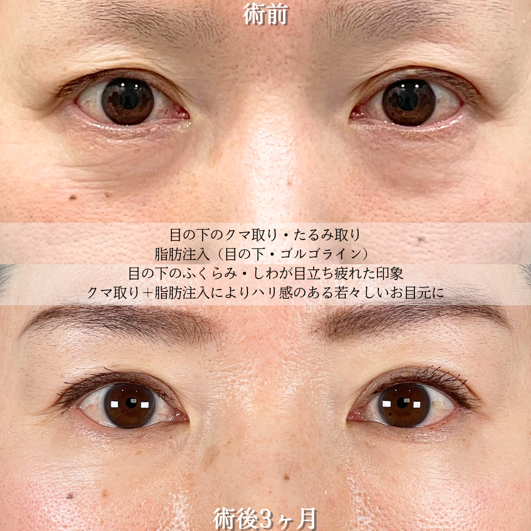 No.21290の症例写真2