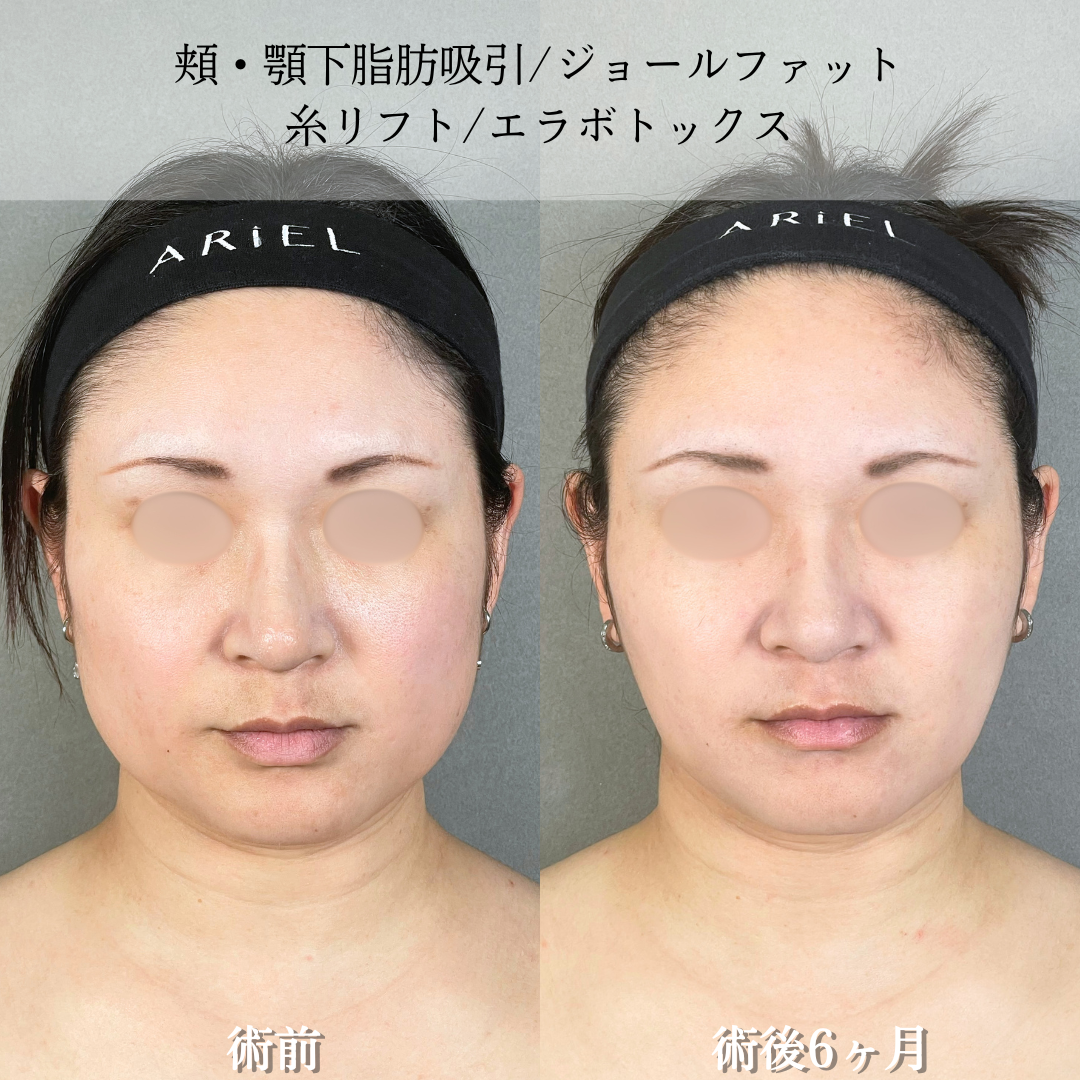 No.21329の症例写真2