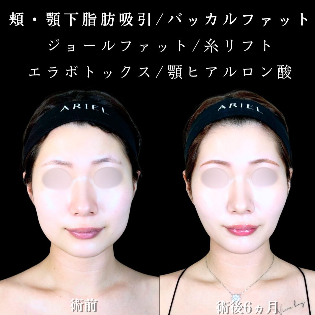 No.21347の症例写真2