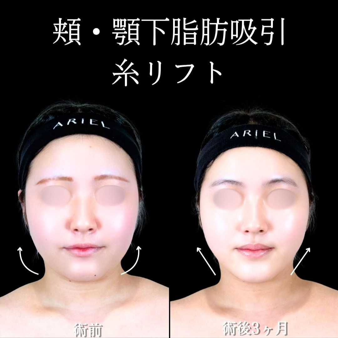 No.21244の症例写真