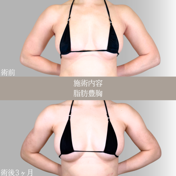 No.21643の症例写真