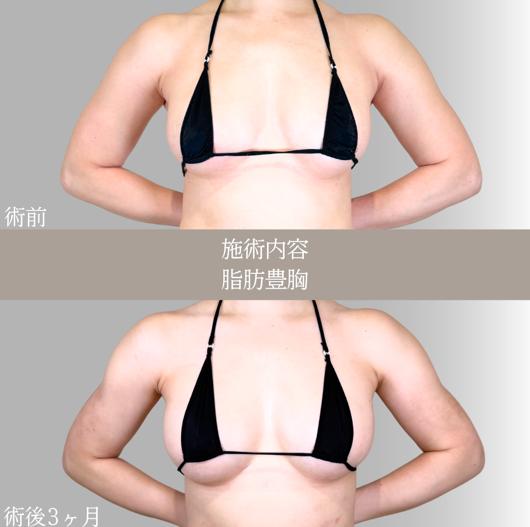 No.21643の症例写真