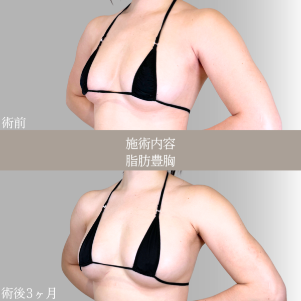 No.21651の症例写真