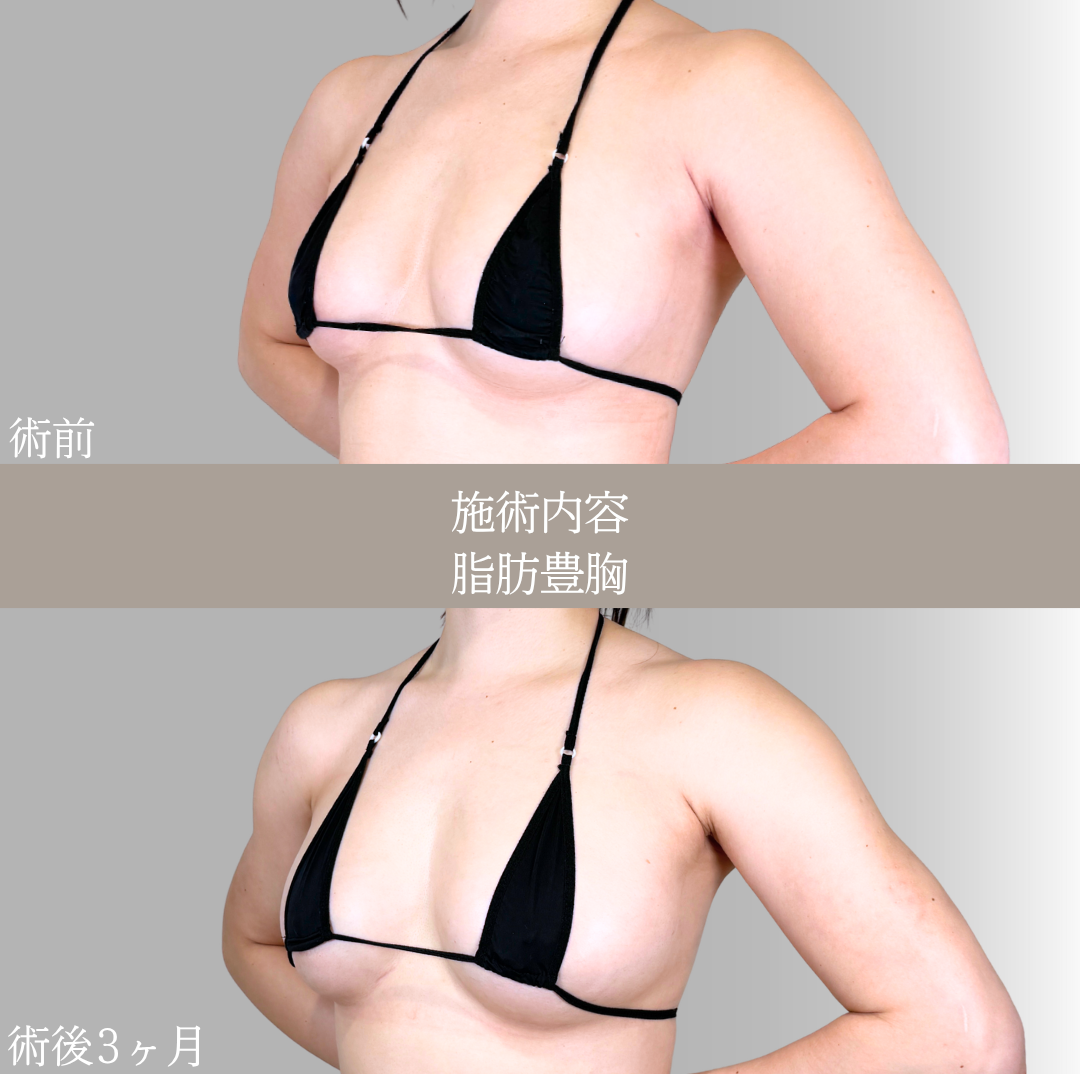 No.21651の症例写真