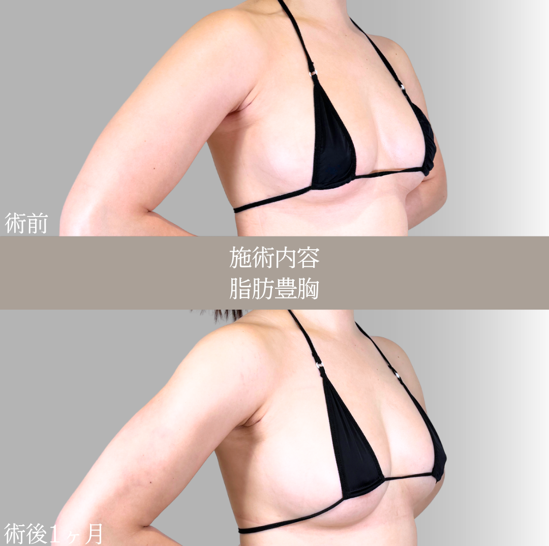 No.21656の症例写真