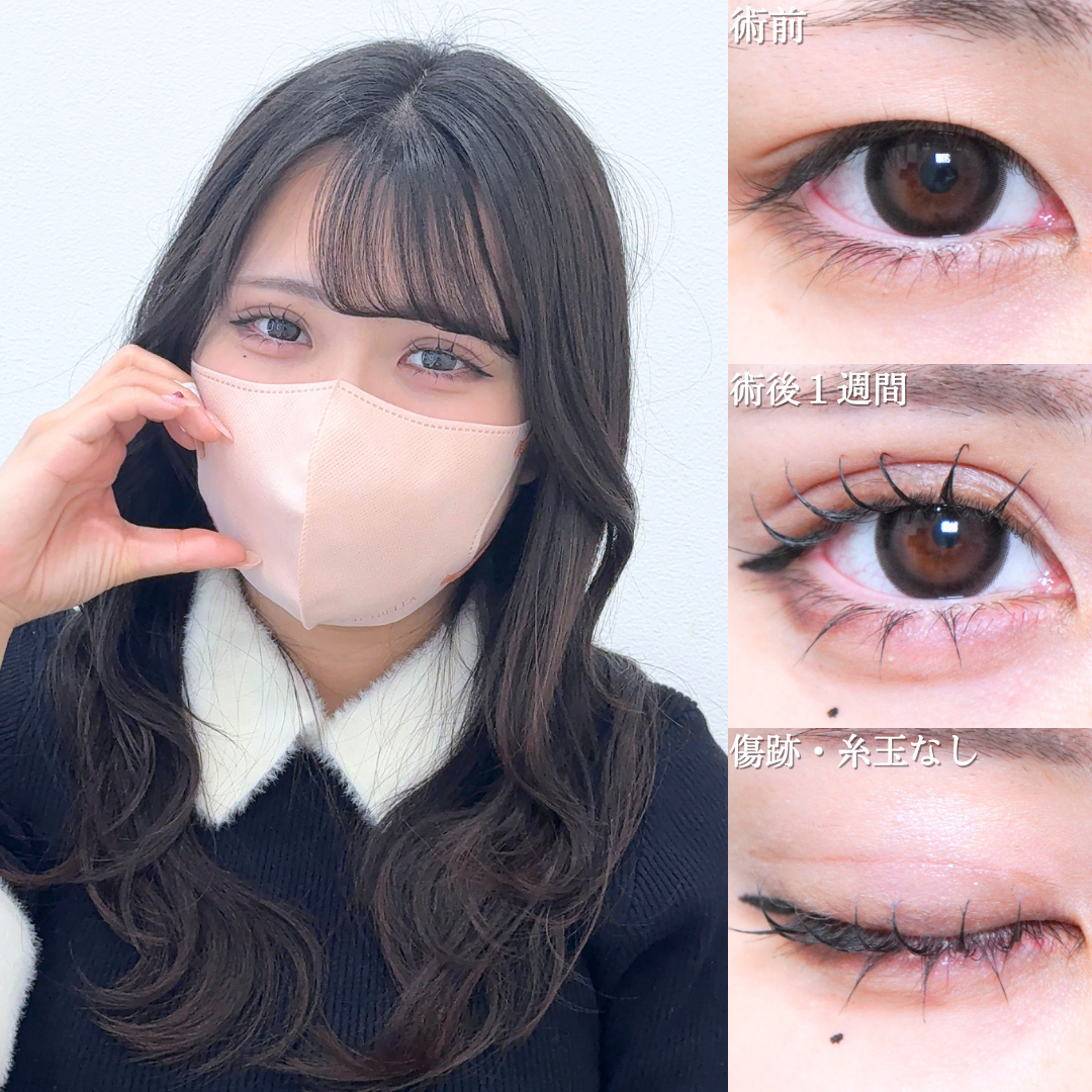 No.21527の症例写真