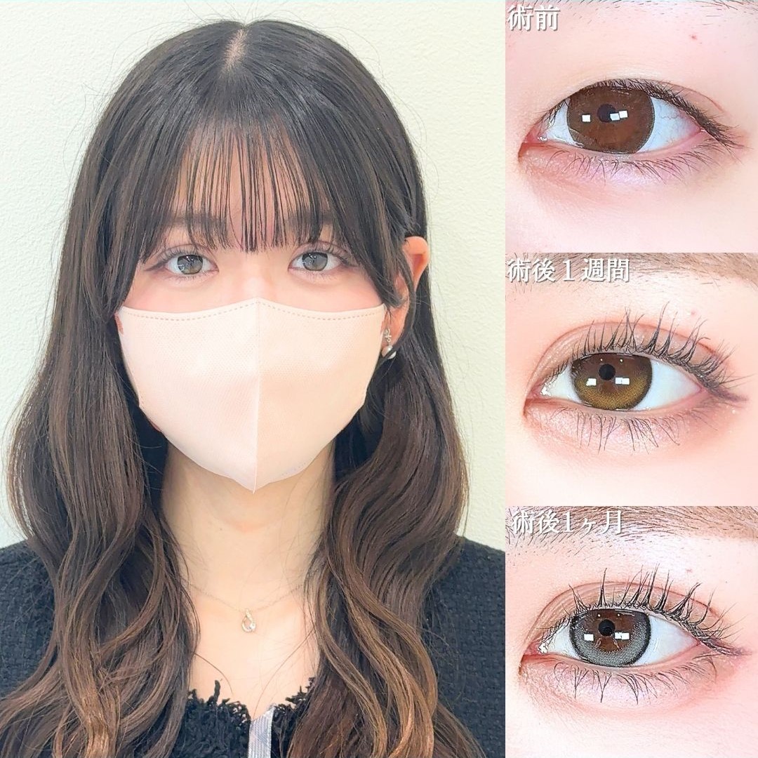 No.21669の症例写真