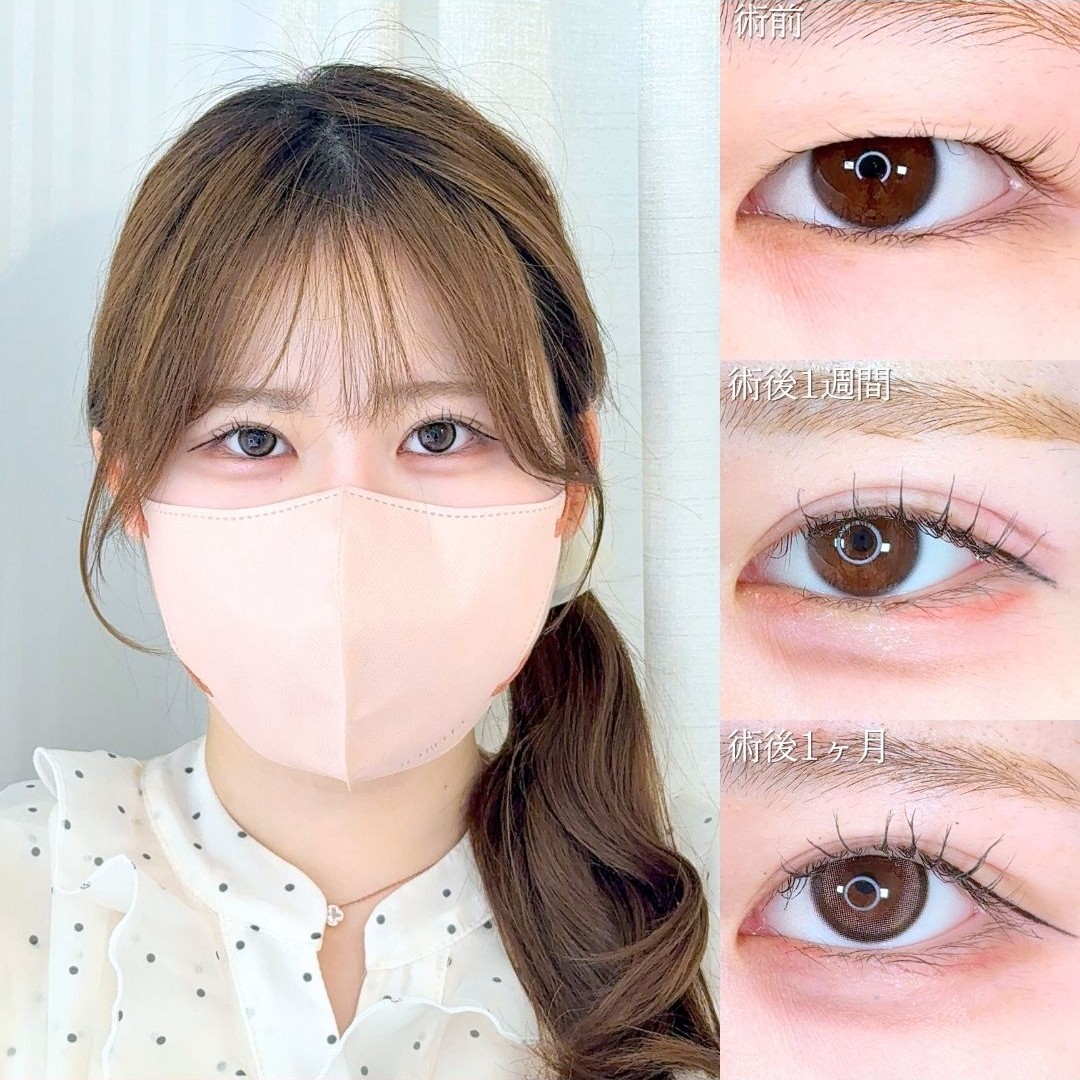 No.21693の症例写真