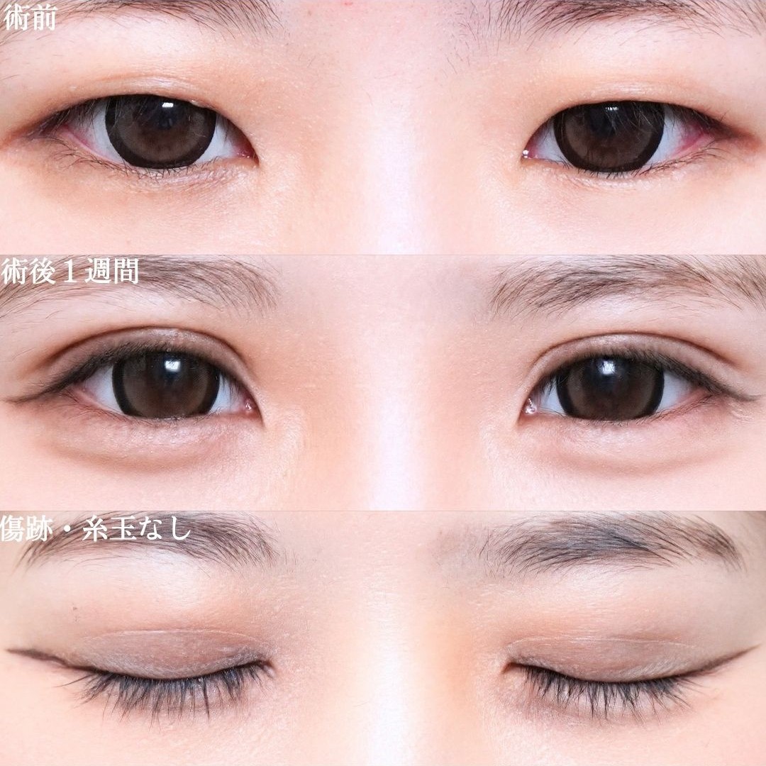 No.21850の症例写真