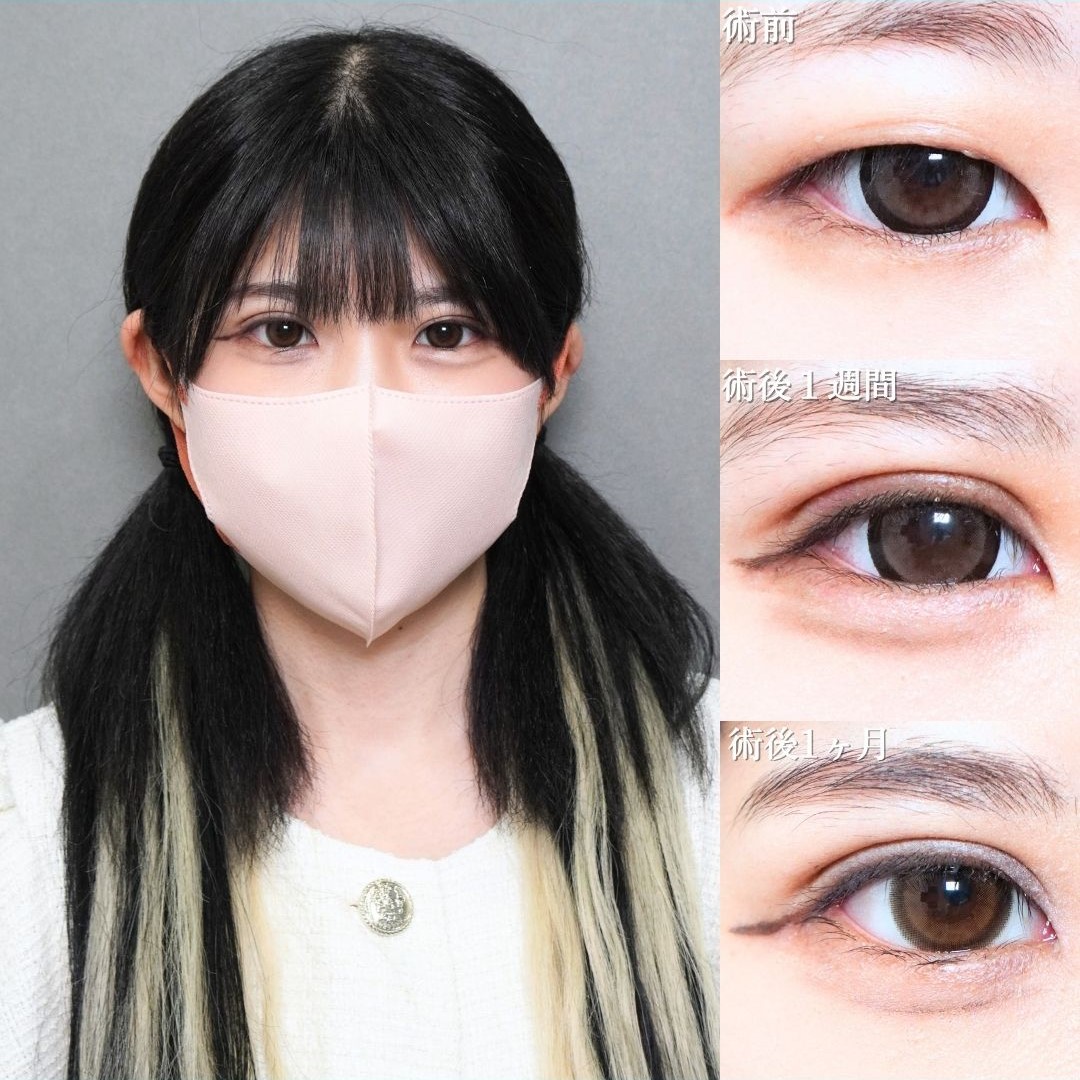 No.21883の症例写真