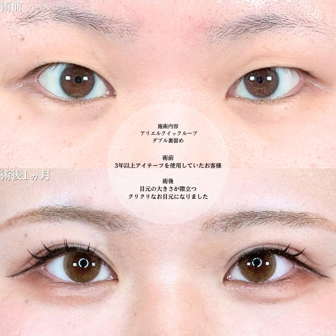 No.21202の症例写真1