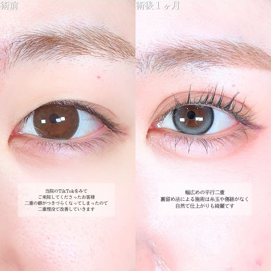 No.21669の症例写真1