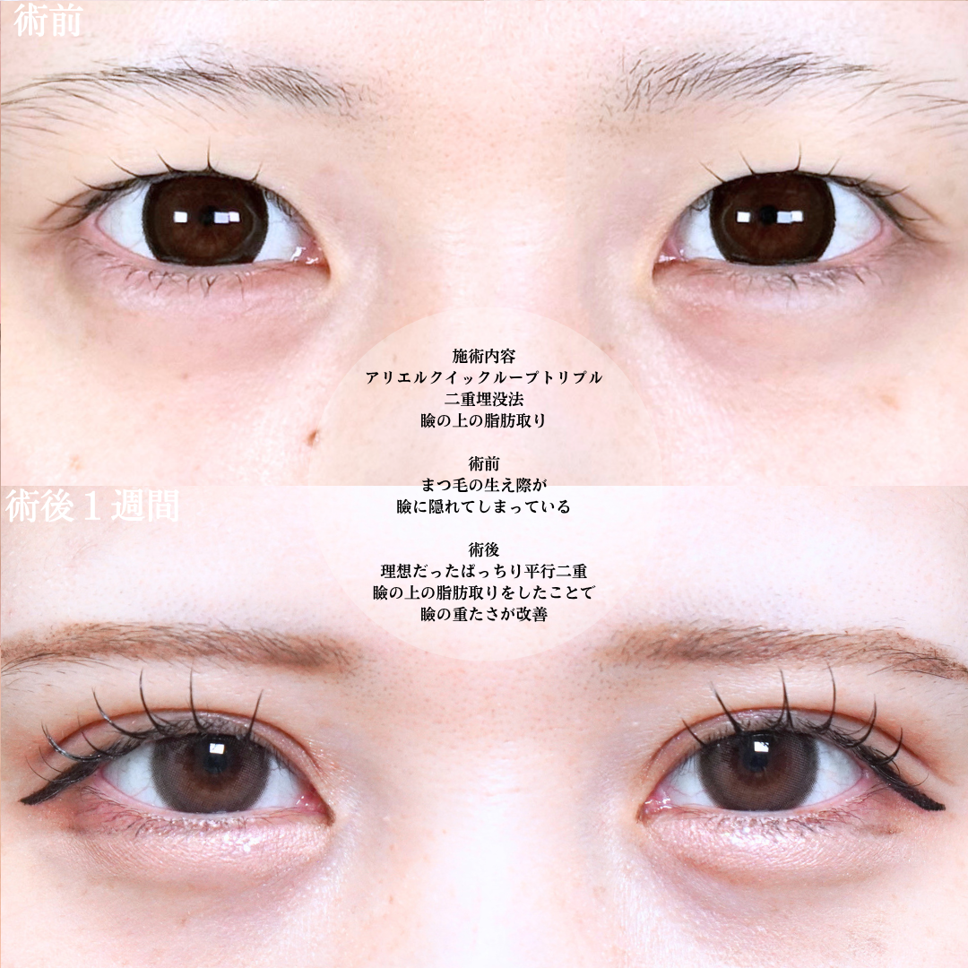 No.21817の症例写真1