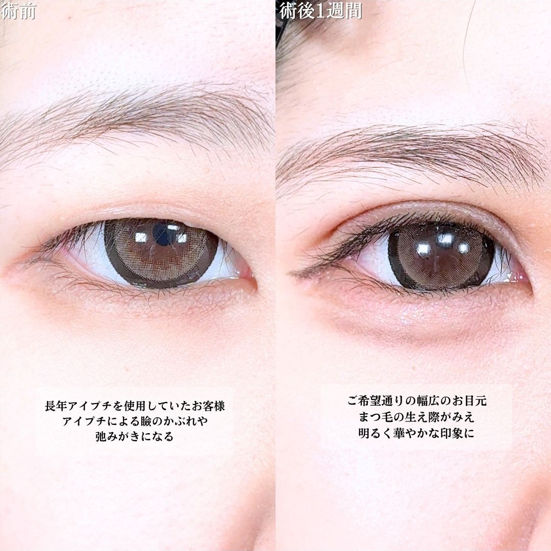 No.21175の症例写真1