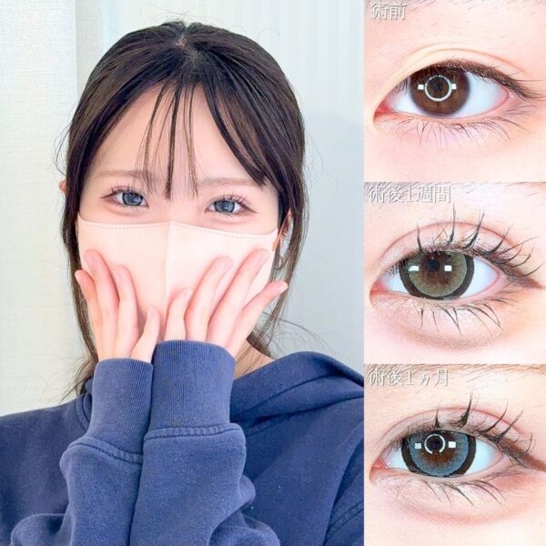No.21428の症例写真