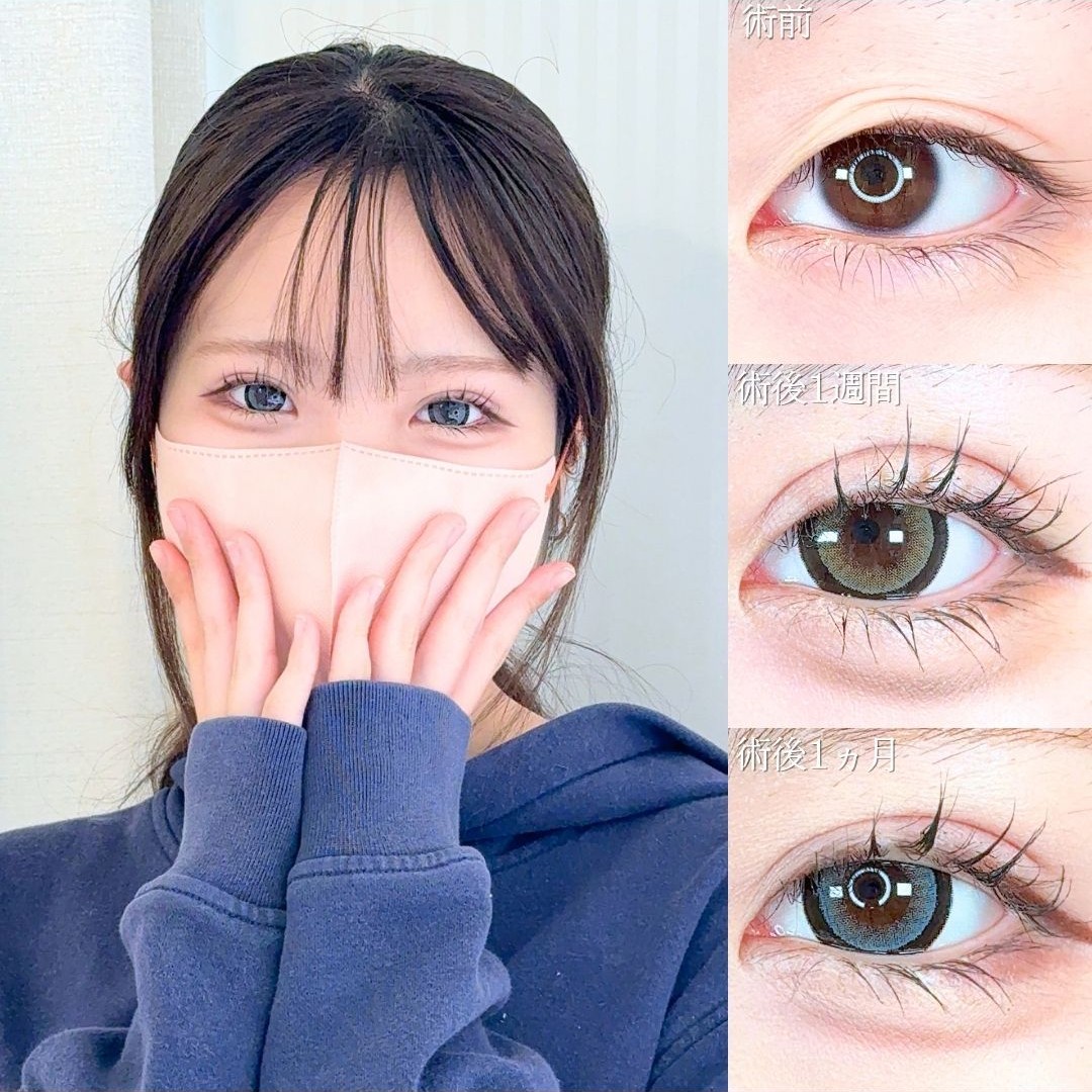 No.21428の症例写真