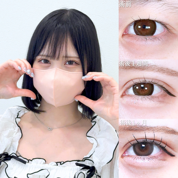 No.21615の症例写真