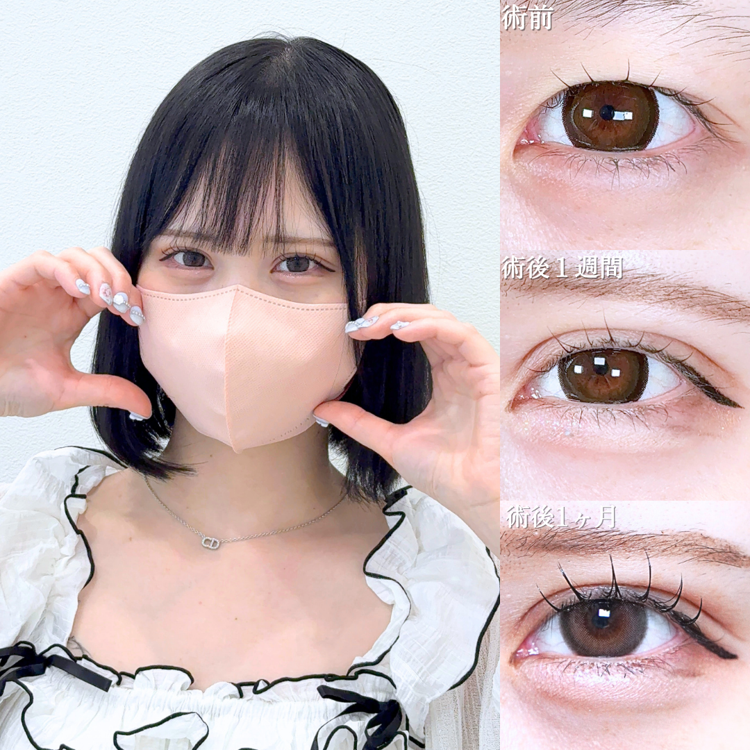 No.21615の症例写真