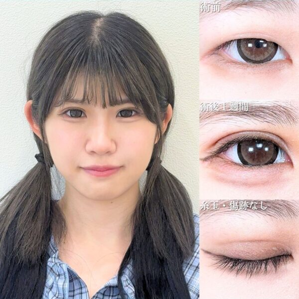 No.21175の症例写真