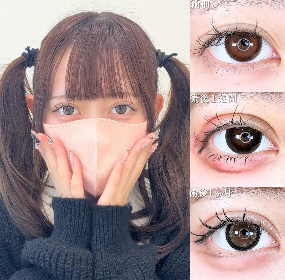 No.21361の症例写真