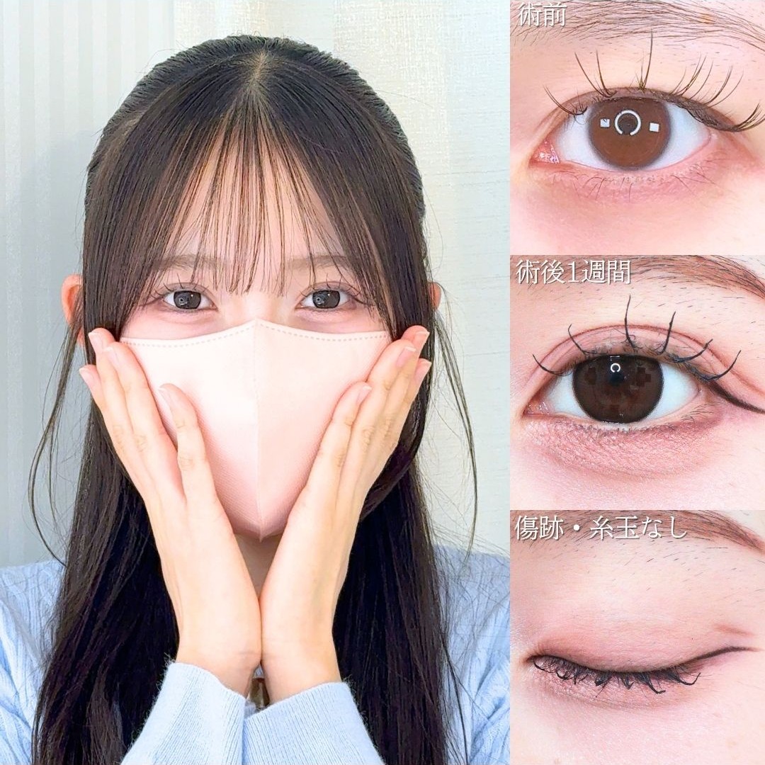 No.21482の症例写真