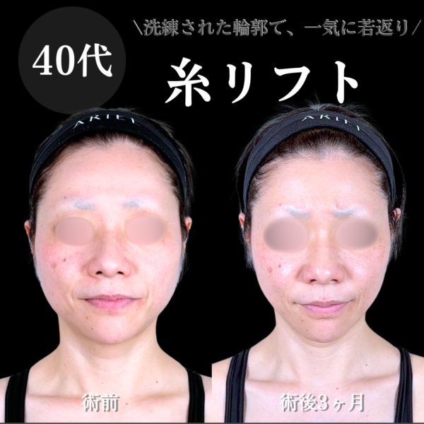 No.21675の症例写真