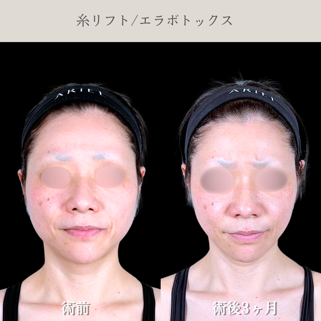 No.21675の症例写真2