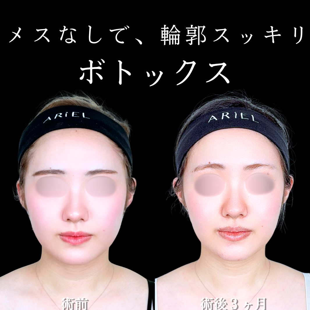 No.21332の症例写真