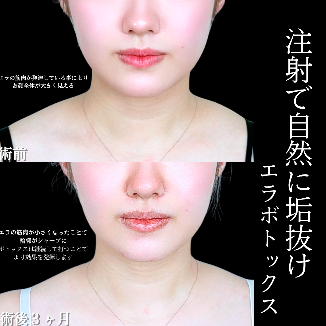 No.21332の症例写真1