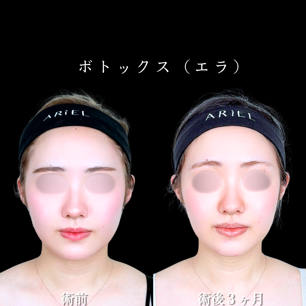 No.21332の症例写真2