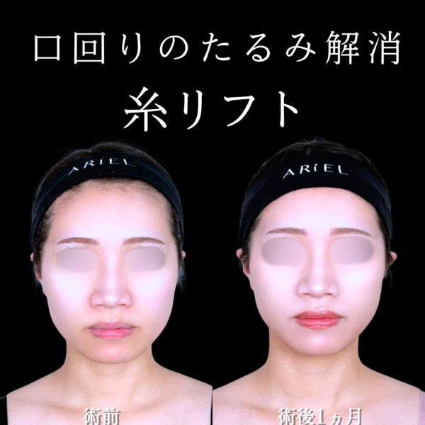 No.21473の症例写真