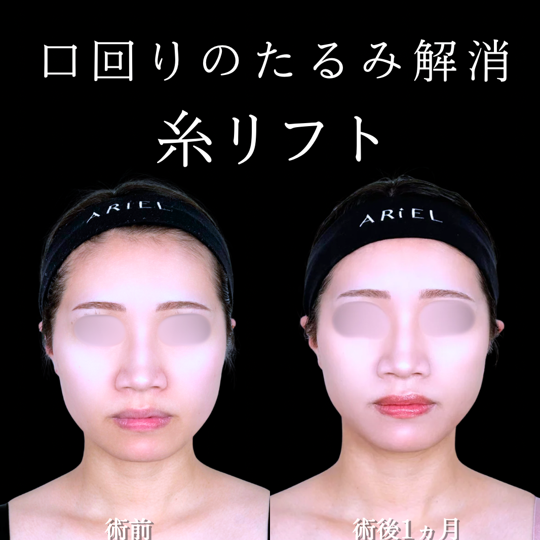 No.21473の症例写真