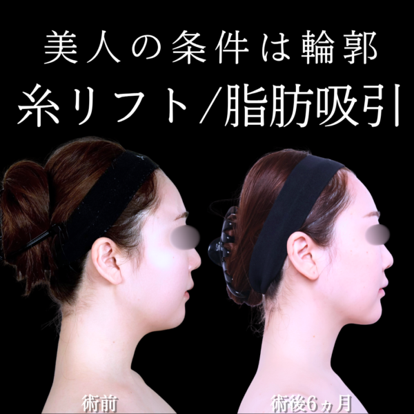 No.21554の症例写真