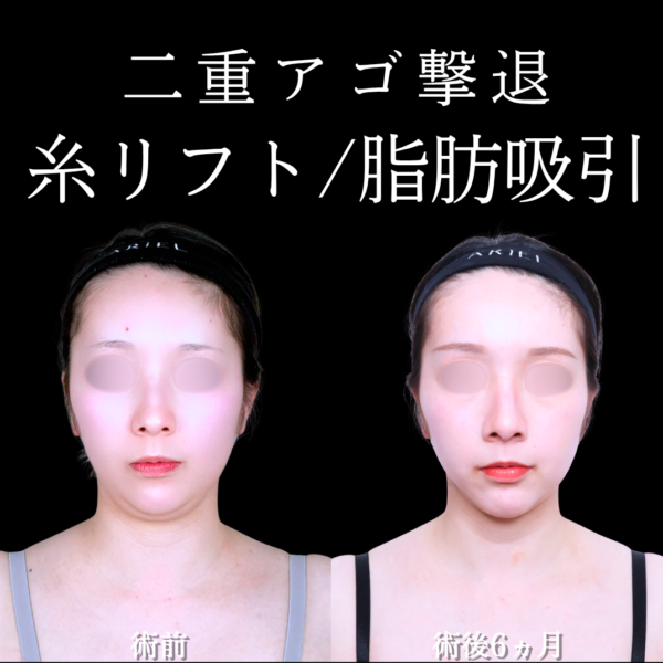 No.21662の症例写真