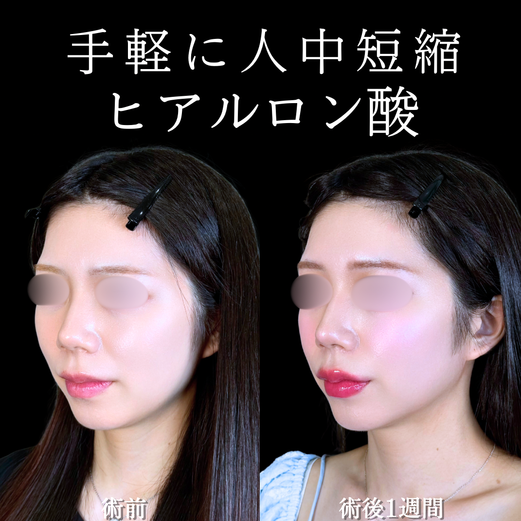 No.21872の症例写真