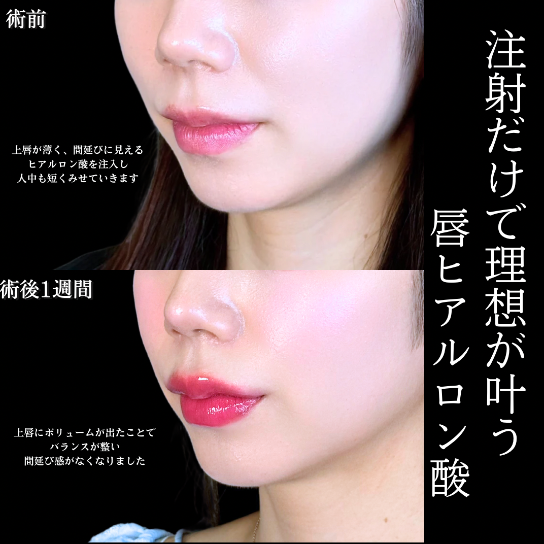 No.21872の症例写真1