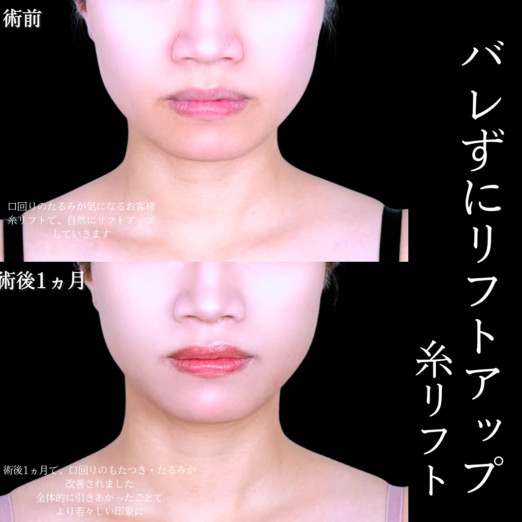 No.21473の症例写真1