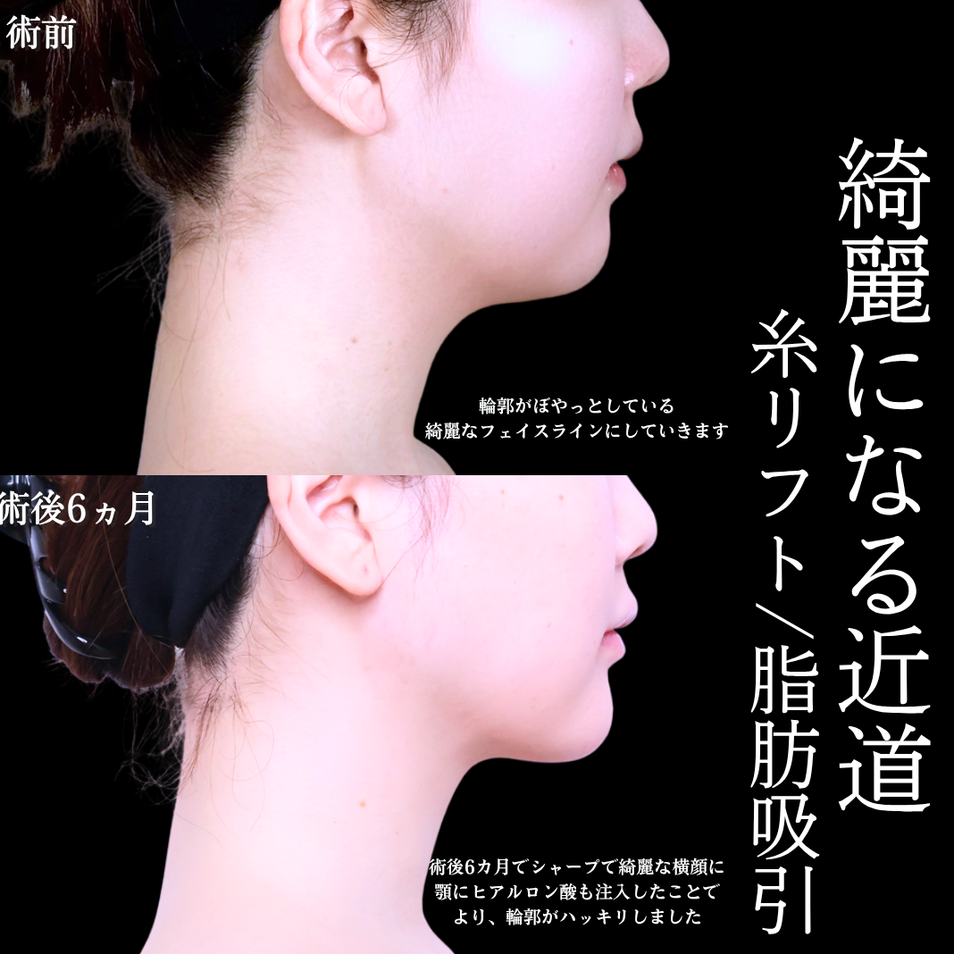 No.21554の症例写真1