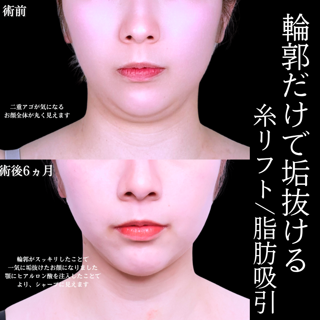 No.21662の症例写真1