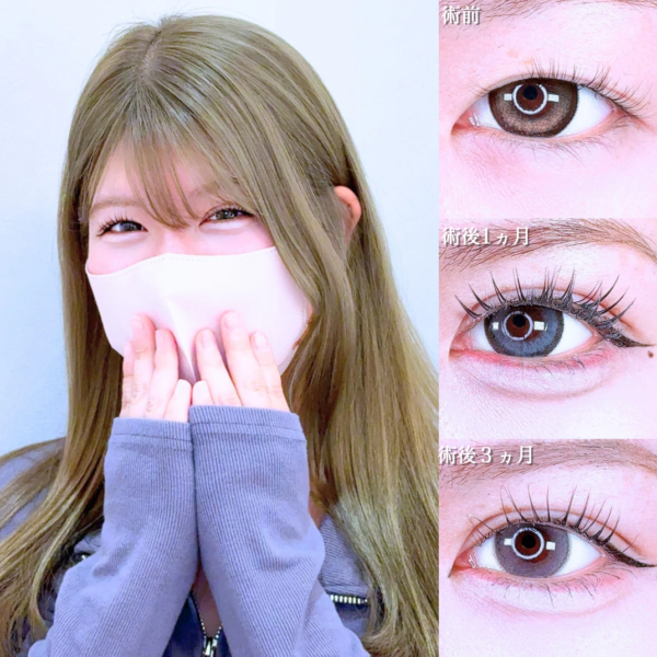 No.21315の症例写真