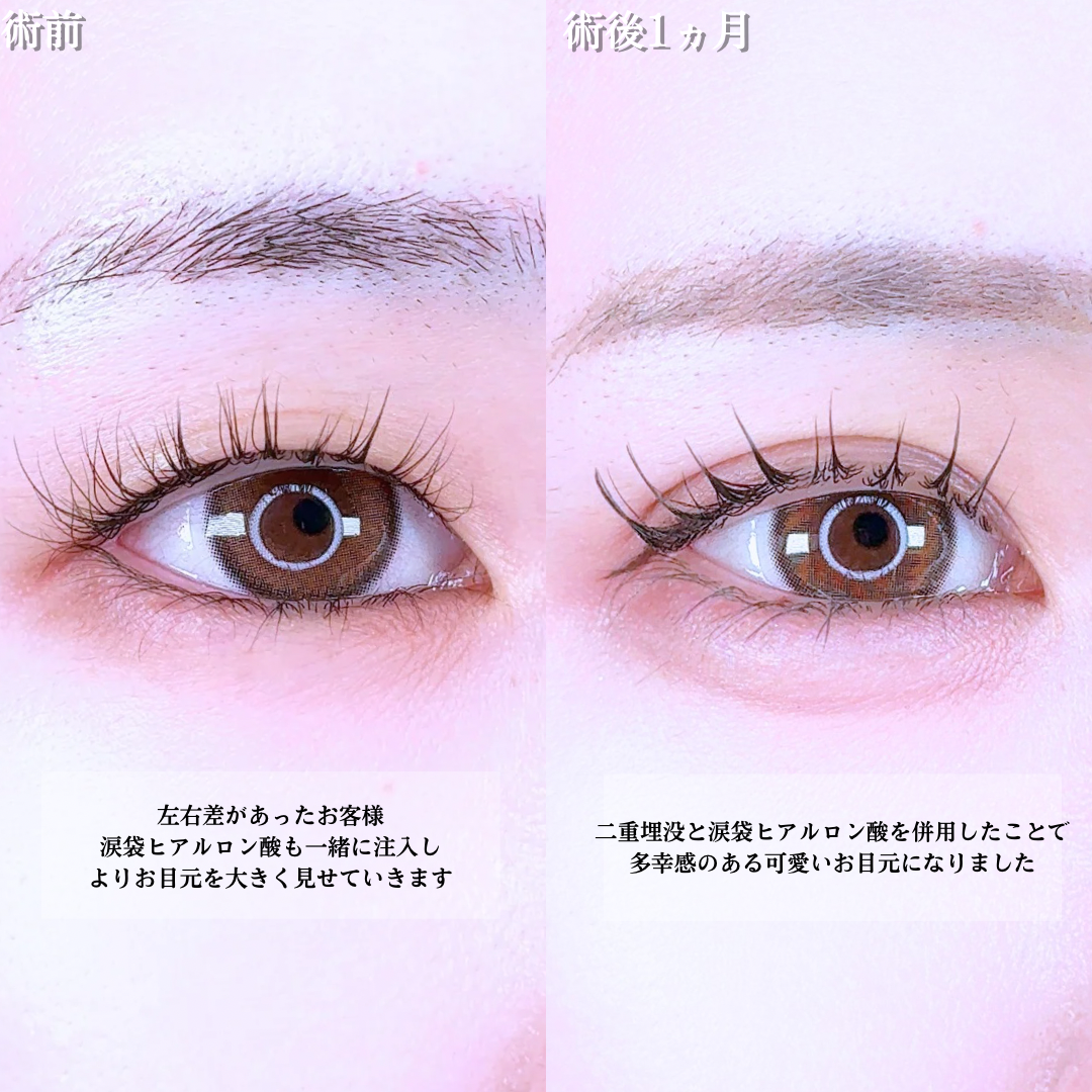 No.21396の症例写真1