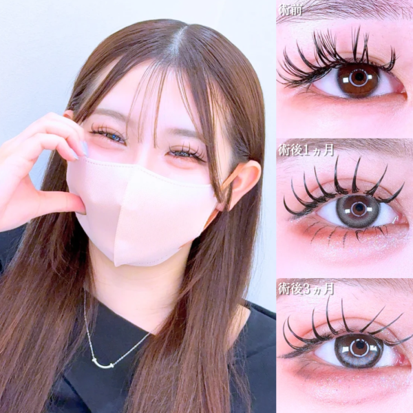 No.21533の症例写真
