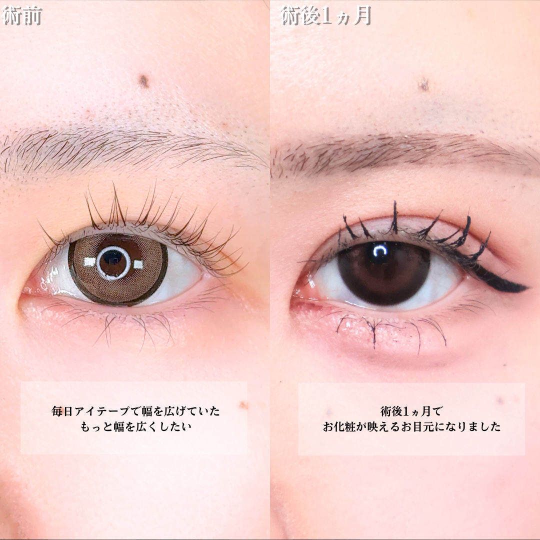 No.21628の症例写真1