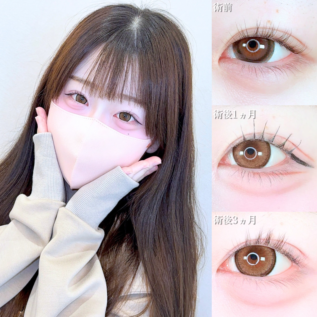 No.21839の症例写真