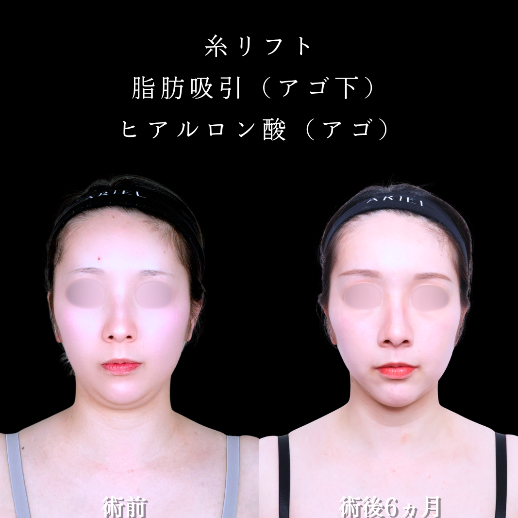 No.21662の症例写真2