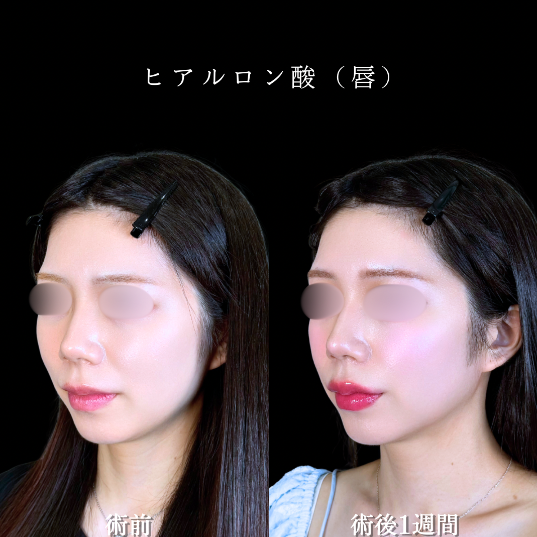 No.21872の症例写真2