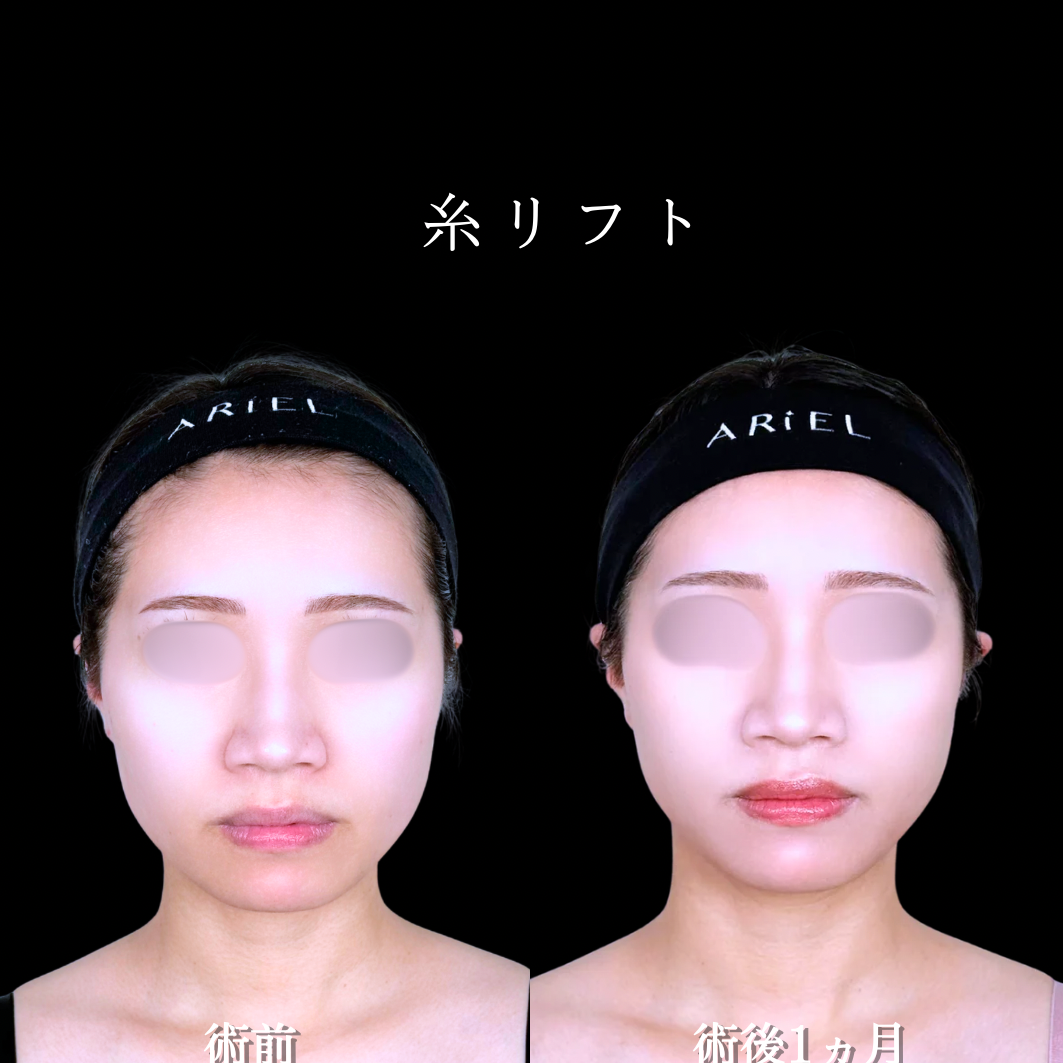 No.21473の症例写真2