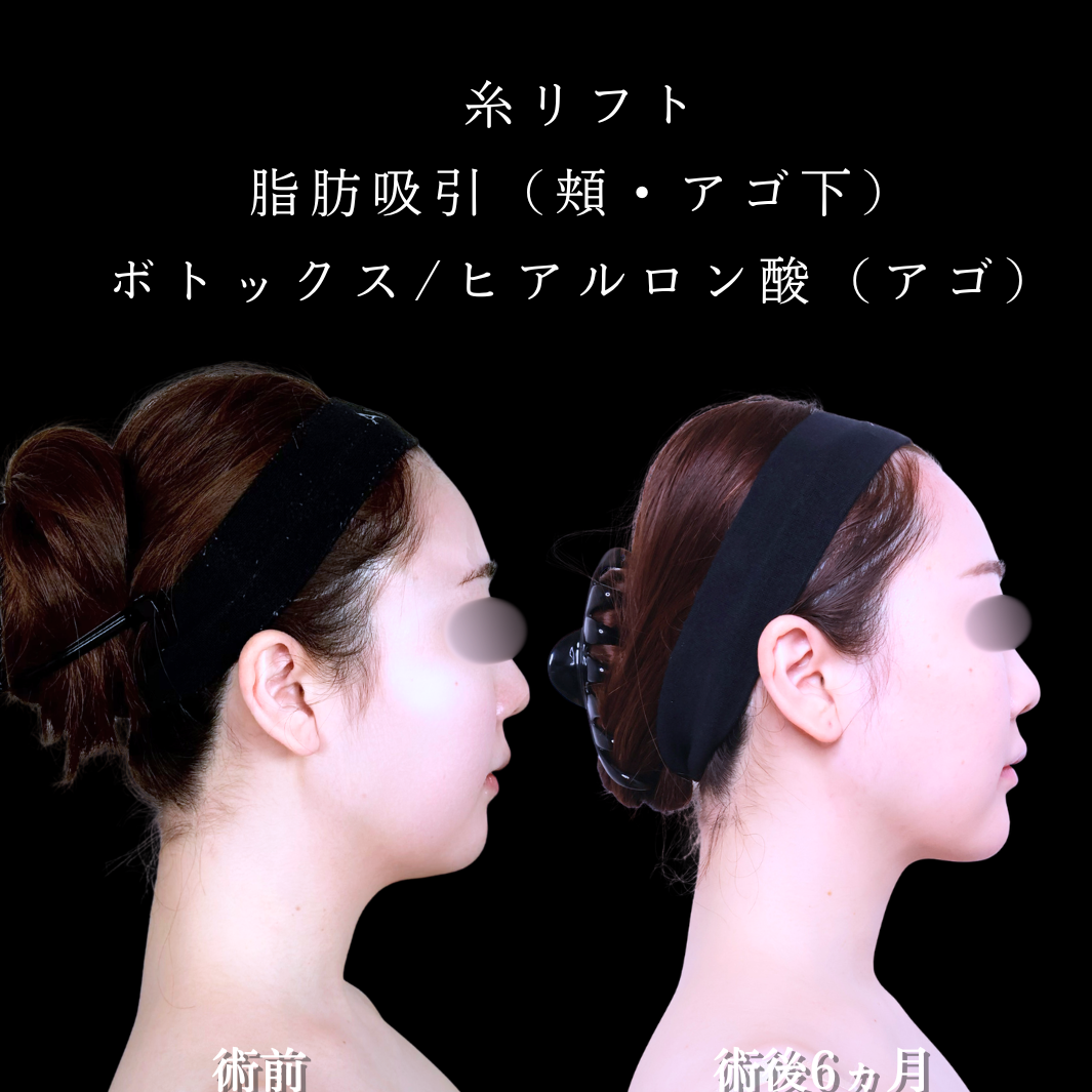 No.21554の症例写真2